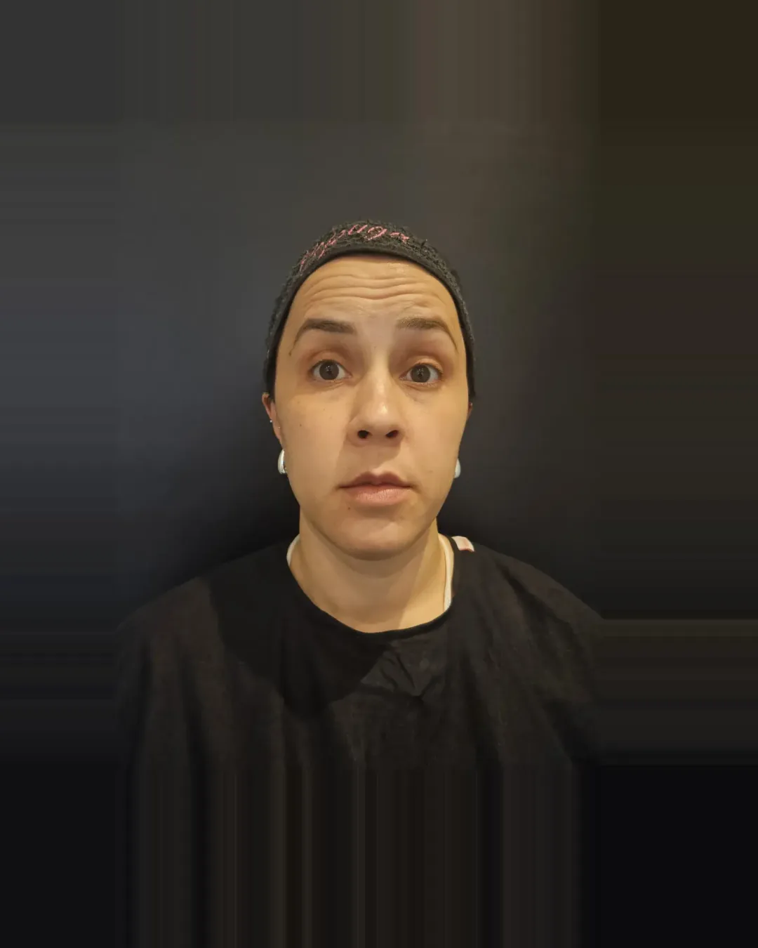 Antes — Toxina Botulínica — Testa