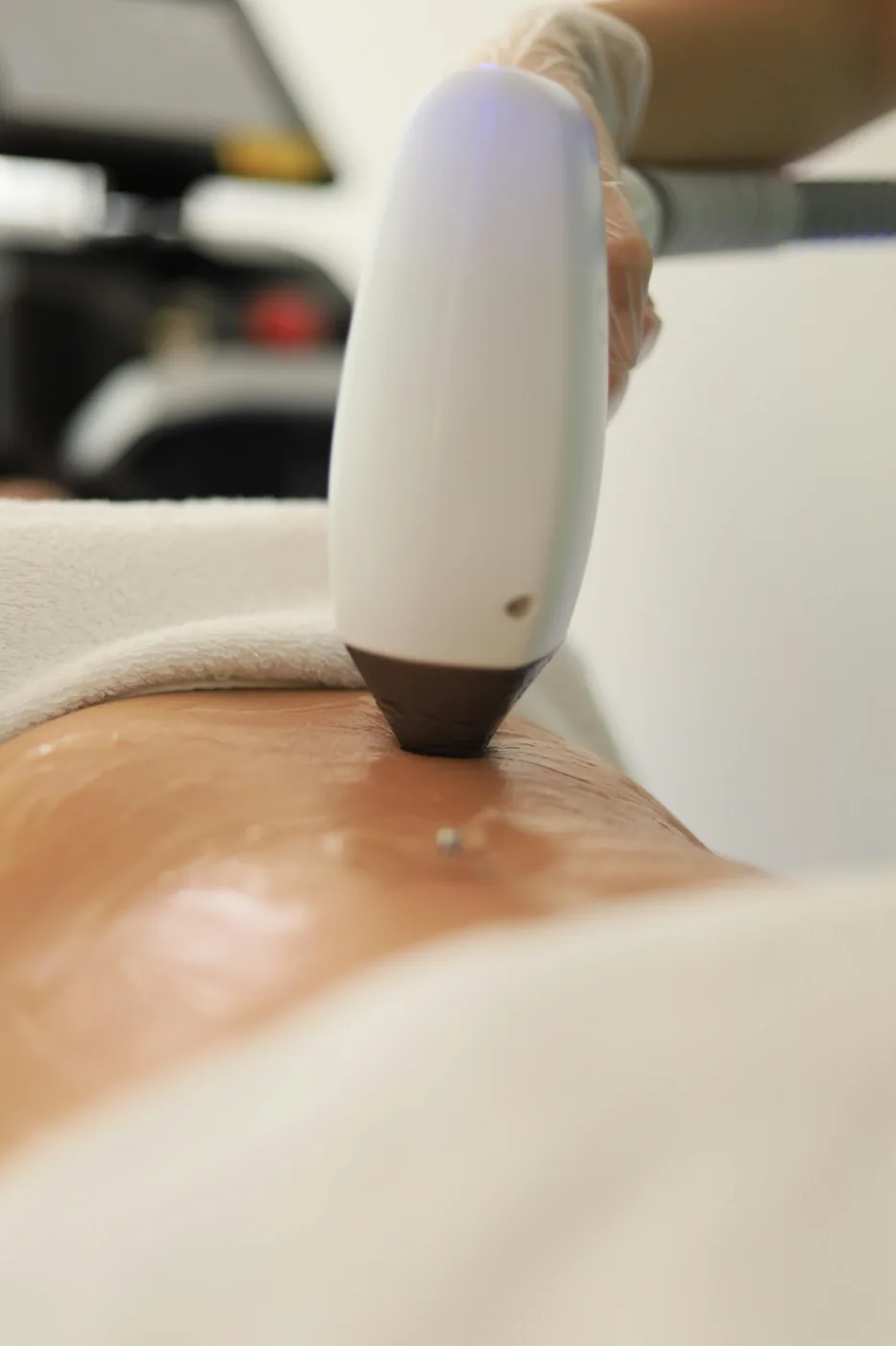 Hidrolipoclasia Não Aspirativa